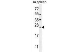 Western Blotting (WB) image for anti-LIM Domain Only 4 (LMO4) antibody (ABIN2995822) (LMO4 antibody)