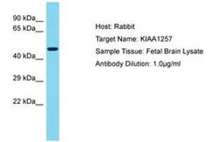 Image no. 1 for anti-Cilia and Flagella Associated Protein 92 (CFAP92) (AA 314-363) antibody (ABIN6750571) (CFAP92/KIAA1257 antibody  (AA 314-363))