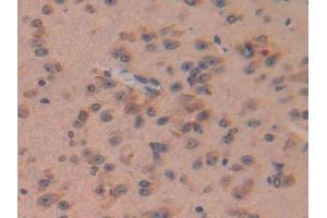 IHC-P analysis of Mouse Brain Tissue, with DAB staining. (PACAP antibody  (AA 1-175))