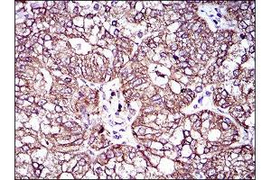 Immunohistochemistry (IHC) image for anti-ATP-Binding Cassette, Sub-Family C (CFTR/MRP), Member 4 (ABCC4) (AA 631-692) antibody (ABIN1845663) (ABCC4 antibody  (AA 631-692))