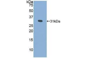 Detection of Recombinant GLa, Human using Polyclonal Antibody to Galactosidase Alpha (GLa) (GLA antibody  (AA 147-371))
