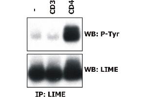 Induction of LIME tyrosine phosphorylation. (LIME antibody  (AA 141-295))