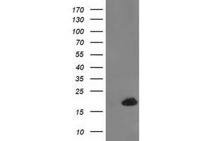 HEK293T cells were transfected with the pCMV6-ENTRY control (Left lane) or pCMV6-ENTRY DSTN (Right lane) cDNA for 48 hrs and lysed. (Destrin antibody)