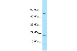 WB Suggested Anti-DAZAP2 Antibody Titration: 1. (DAZAP2 antibody  (C-Term))