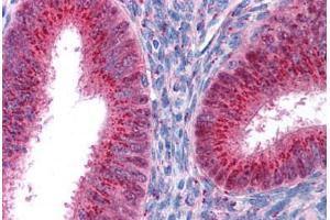 Human Uterus (formalin-fixed, paraffin-embedded) stained with FOXA1 antibody ABIN214751 at 5 ug/ml followed by biotinylated goat anti-rabbit IgG secondary antibody ABIN481713, alkaline phosphatase-streptavidin and chromogen. (FOXA1 antibody  (AA 395-444))