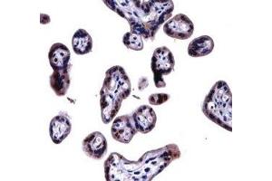 SOCS6 antibody immunohistochemistry analysis in formalin fixed and paraffin embedded human placenta tissue. (SOCS6 antibody  (AA 40-69))