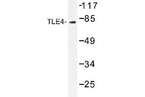 Image no. 1 for anti-Transducin-like Enhancer Protein 4 (TLE4) antibody (ABIN272213) (TLE4 antibody)