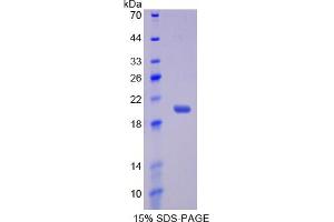 Image no. 1 for Interleukin 17 Receptor B (IL17RB) (AA 61-200) protein (His tag) (ABIN6238012) (IL17 Receptor B Protein (AA 61-200) (His tag))