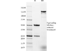 SDS-PAGE (SDS) image for anti-Epithelial Cell Adhesion Molecule (EPCAM) (AA 77-202), (Extracellular Domain) antibody (ABIN6939979)