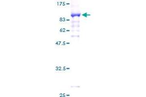 PDLIM5 Protein (AA 1-596) (GST tag)