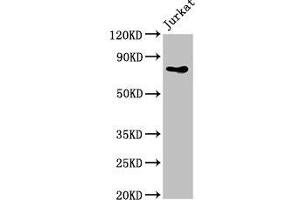 Western Blot Positive WB detected in: Jurkat whole cell lysate All lanes: PIK3R2 antibody at 4 μg/mL Secondary Goat polyclonal to rabbit IgG at 1/50000 dilution Predicted band size: 82 kDa Observed band size: 82 kDa