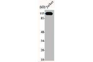 Western Blot analysis of Jurkat cells using ERCC4 Polyclonal Antibody (ERCC4 antibody  (C-Term))