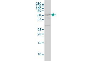 DRD2 monoclonal antibody (M01A), clone 1B11 Western Blot analysis of DRD2 expression in HL-60 . (Dopamine d2 Receptor antibody  (AA 1-110))