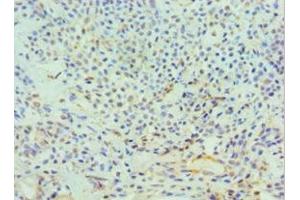 Immunohistochemistry (IHC) image for anti-DNA Fragmentation Factor, 45kDa, alpha Polypeptide (DFFA) (AA 1-331) antibody (ABIN7150176)