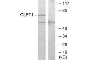 Western blot analysis of extracts from COS7 cells, using CLPT1 Antibody. (CLPTM1 antibody  (AA 200-249))