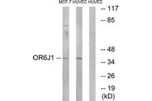 Western blot analysis of extracts from HuvEc/MCF-7 cells, using OR6J1 Antibody. (OR6J1 antibody  (AA 231-280))