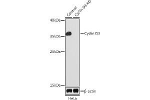 Western blot analysis of extracts from normal (control) and Cyclin D3 knockout (KO) HeLa cells, using Cyclin D3 antibody (ABIN6127731, ABIN6138087, ABIN6138088 and ABIN7101345) at 1:1000 dilution. (Cyclin D3 antibody  (AA 201-292))