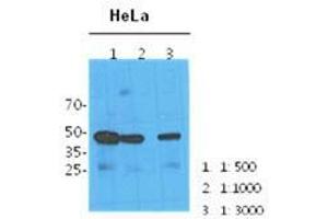 The cell lysates (40 ug) were resolved by SDS-PAGE, transferred to PVDF membrane and probed with anti-human NANS antibody(1:100, 1:1000, 1:3000). (TPMT antibody  (AA 1-359))