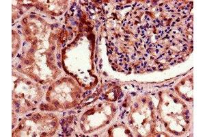 Immunohistochemistry of paraffin-embedded human kidney tissue using ABIN7172838 at dilution of 1:100 (TGFBRAP1 antibody  (AA 401-600))