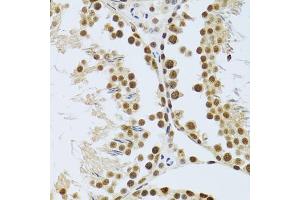 Immunohistochemistry of paraffin-embedded mouse testis using MT antibody (ABIN6128251, ABIN6144117, ABIN6144118 and ABIN6222360) at dilution of 1:100 (40x lens). (MTA3 antibody  (AA 40-330))