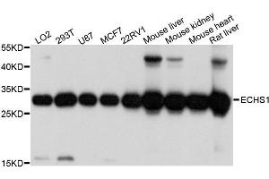 Western blot analysis of extracts of various cell lines, using ECHS1 antibody. (ECHS1 antibody  (AA 28-290))