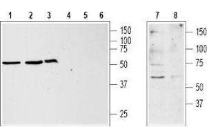 Western blot analysis of Jurkat (lanes 1 and 4), HL-60 (lanes 2 and 5), MCF-7 (lanes 3 and 6) and rat brain (lanes 7 and 8) lysates: - 1,2,3,7. (KISS1R antibody  (3rd Extracellular Loop))