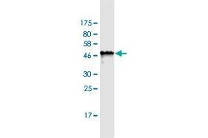 Western Blot detection against Immunogen (42. (PAGE1 antibody  (AA 1-146))