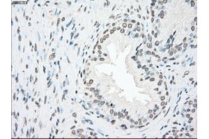 Immunohistochemical staining of paraffin-embedded Ovary tissue using anti-PLK1mouse monoclonal antibody. (PLK1 antibody)