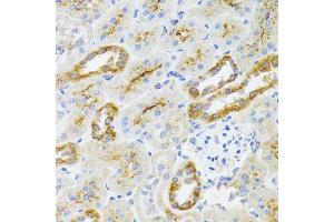 Immunohistochemistry of paraffin-embedded rat kidney using  antibody (ABIN6129960, ABIN6136680, ABIN6136681 and ABIN6224707) at dilution of 1:100 (40x lens). (AIFM3 antibody  (AA 1-200))