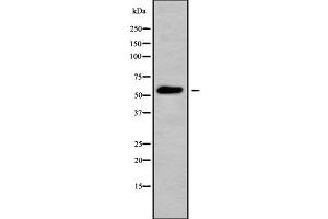 Western blot analysis of MOT6 using HepG2 whole cell lysates (SLC16A5 antibody  (Internal Region))