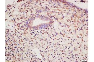 Formalin-fixed and paraffin embedded human endometrium tissue labeled with bs-3334R, Unconjugated  at 1:200 followed by conjugation to the secondary antibody and DAB staining (PKM2 antibody  (pTyr105))