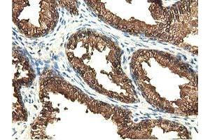 Immunohistochemical staining of paraffin-embedded Human liver tissue using anti-EPHX2 mouse monoclonal antibody.