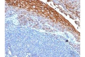 Formalin-fixed, paraffin-embedded human tonsil stained with CD146 antibody (MUC18/1130)