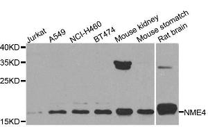 Western blot analysis of extracts of various cell lines, using NME4 antibody. (NME4 antibody  (AA 1-187))