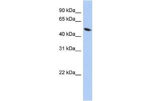 WB Suggested Anti-ZNF793 Antibody Titration:  0. (ZNF793 antibody  (Middle Region))