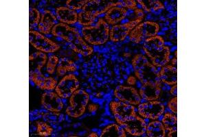 Immunofluorescence (Paraffin-embedded Sections) (IF (p)) image for anti-Neuropilin 2 (NRP2) antibody (ABIN7074826)