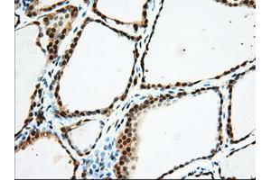 Immunohistochemical staining of paraffin-embedded Human Kidney tissue using anti-USP5 mouse monoclonal antibody. (USP5 antibody)
