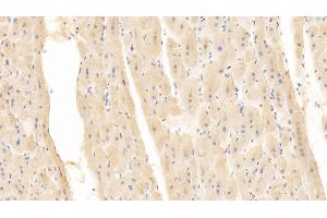 Detection of CD40L in Human Cardiac Muscle Tissue using Monoclonal Antibody to Cluster Of Differentiation 40 Ligand (CD40L) (CD40 Ligand antibody  (AA 48-244))