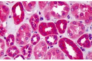 Human Kidney: Formalin-Fixed, Paraffin-Embedded (FFPE) (SLIT1 antibody  (AA 487-504))