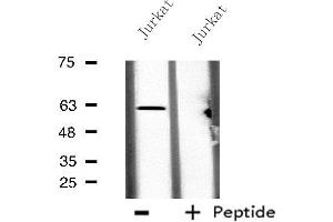 Western blot analysis of extracts from Jurkat cells, using CES2 antibody. (CES2 antibody  (N-Term))