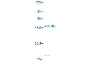 Image no. 1 for Mitochondrial Ribosomal Protein L22 (MRPL22) (AA 1-206) protein (GST tag) (ABIN1311307) (MRPL22 Protein (AA 1-206) (GST tag))