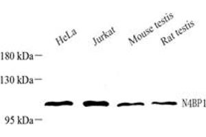 Western blot analysis of N4BP1 (ABIN7074790),at dilution of 1: 1000,Lane 1: HeLa cell lysate,Lane 2: Jurkat cell lysate,Lane 3: Mouse testis tissue lysate,Lane 4: Rat testis tissue lysate (N4BP1 antibody)
