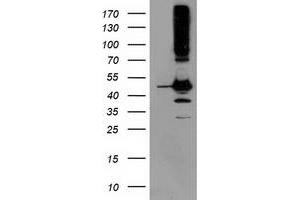 Western Blotting (WB) image for anti-serpin Peptidase Inhibitor, Clade B (Ovalbumin), Member 13 (SERPINB13) antibody (ABIN1500877) (SERPINB13 antibody)