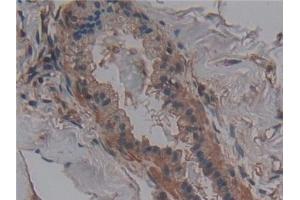 Immunohistochemistry (IHC) image for anti-Anoctamin 6 (ANO6) (AA 744-824) antibody (ABIN7436141)