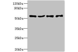 Western blot All lanes: UBA5 antibody at 6 μg/mL Lane 1: Jurkat whole cell lysate Lane 2: Hela whole cell lysate Lane 3: HepG2 whole cell lysate Lane 4: Caco-2 whole cell lysate Secondary Goat polyclonal to rabbit IgG at 1/10000 dilution Predicted band size: 45, 39 kDa Observed band size: 45 kDa (UBA5 antibody  (AA 291-404))