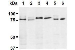 Western Blotting (WB) image for anti-UV Radiation Resistance Associated Gene (UVRAG) (AA 389-699) antibody (ABIN1449295) (UVRAG antibody  (AA 389-699))