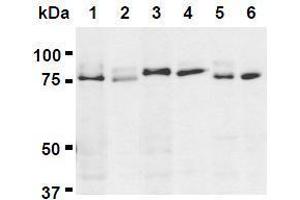 Western Blotting (WB) image for anti-UV Radiation Resistance Associated Gene (UVRAG) (AA 389-699) antibody (ABIN1449295)