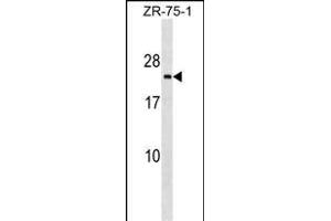 TMED3 Antibody (C-term) (ABIN1536734 and ABIN2849106) western blot analysis in ZR-75-1 cell line lysates (35 μg/lane).