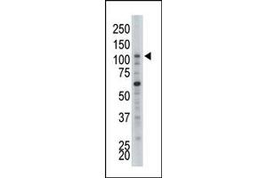 Image no. 1 for anti-Hexokinase 2 (HK2) (N-Term) antibody (ABIN360640) (Hexokinase 2 antibody  (N-Term))