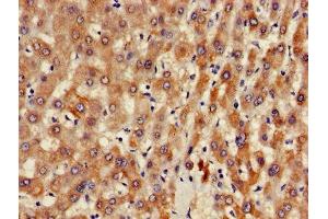 Immunohistochemistry of paraffin-embedded human liver tissue using ABIN7144576 at dilution of 1:100